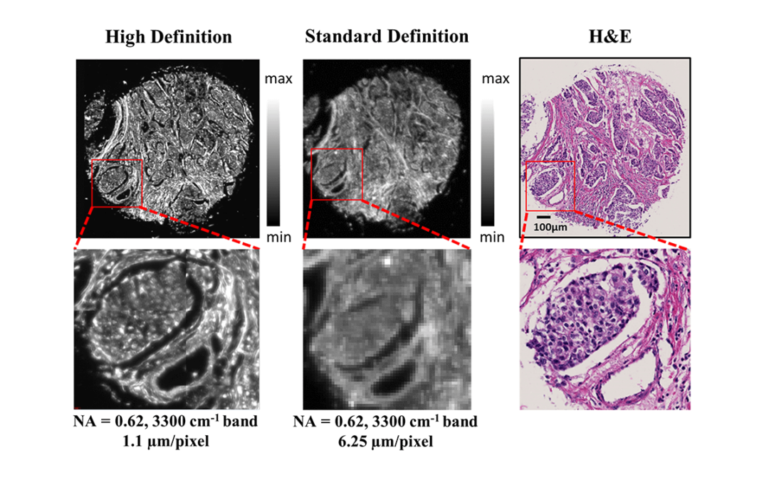 Comparisons of high definition and standard definition infrared imaging for digital histopathology