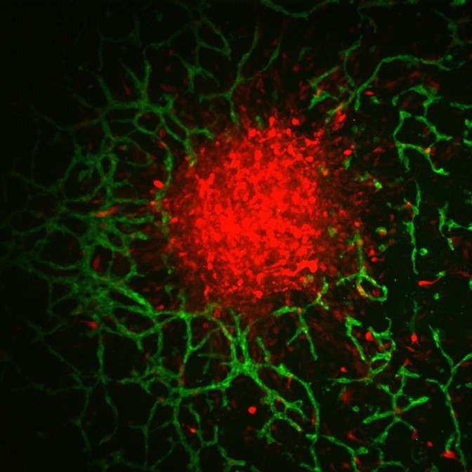 Illinois scientists develop brain perivascular model for glioblastoma research
